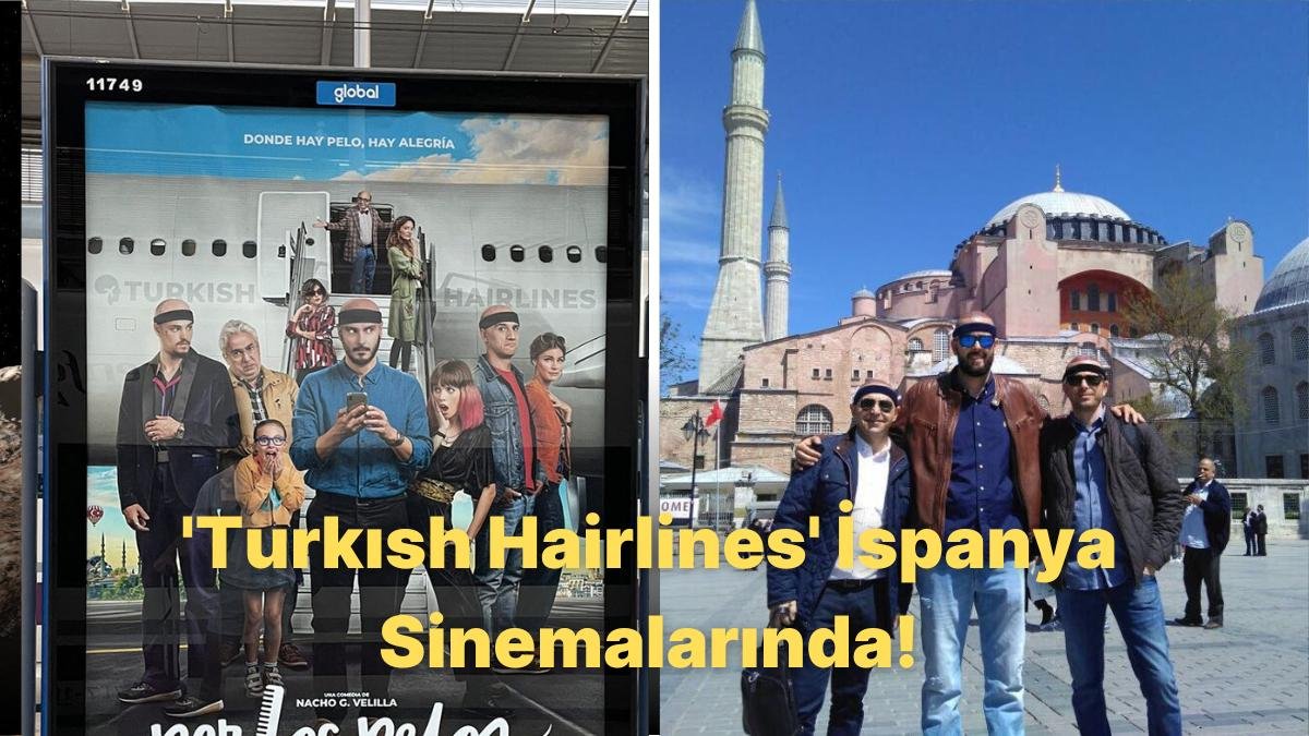 Şöhreti Türkiye’yi Aşan Saç Ektirme Tedavisi İspanya Sinemasında Yer Alacak: Turkish Hairlines