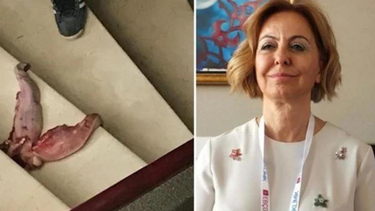 Prof. Dr. Esin Şenol’u ‘Dana Dili’ ile Tehdit Etmişti! Sahte Doktor Çıktı