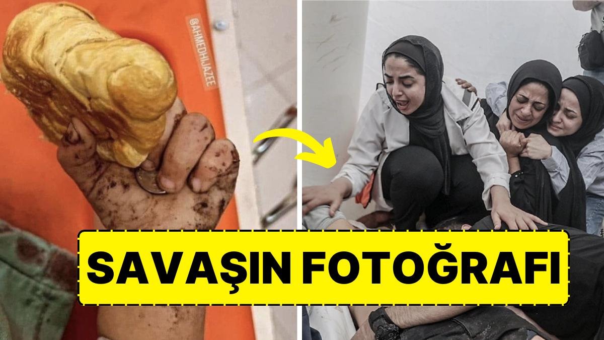 Hastane Saldırısı Sonrasında Elinde Bir Parça Ekmek Tutan Çocuk Yaşanan Acıyı Gözler Önüne Serdi