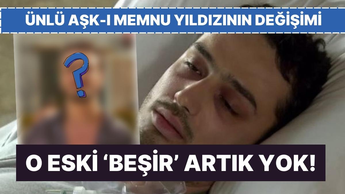 O Eski Halinden Eser Yok Şimdi: Aşk-ı Memnu’nun Beşir’i Baran Akbulut’un Dikkat Çeken Değişimi