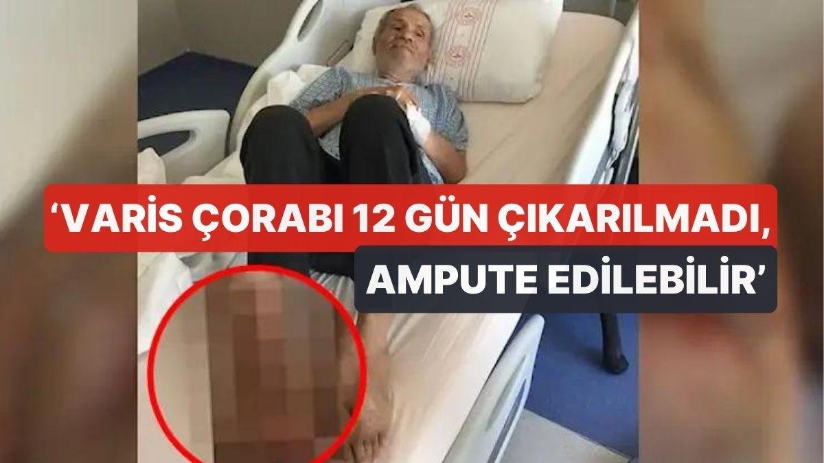 Şehir Hastanesinde İhmal İddiası! ‘Varis Çorabı 12 Gün Çıkarılmadı, Parmağı Ampute Edilebilir’