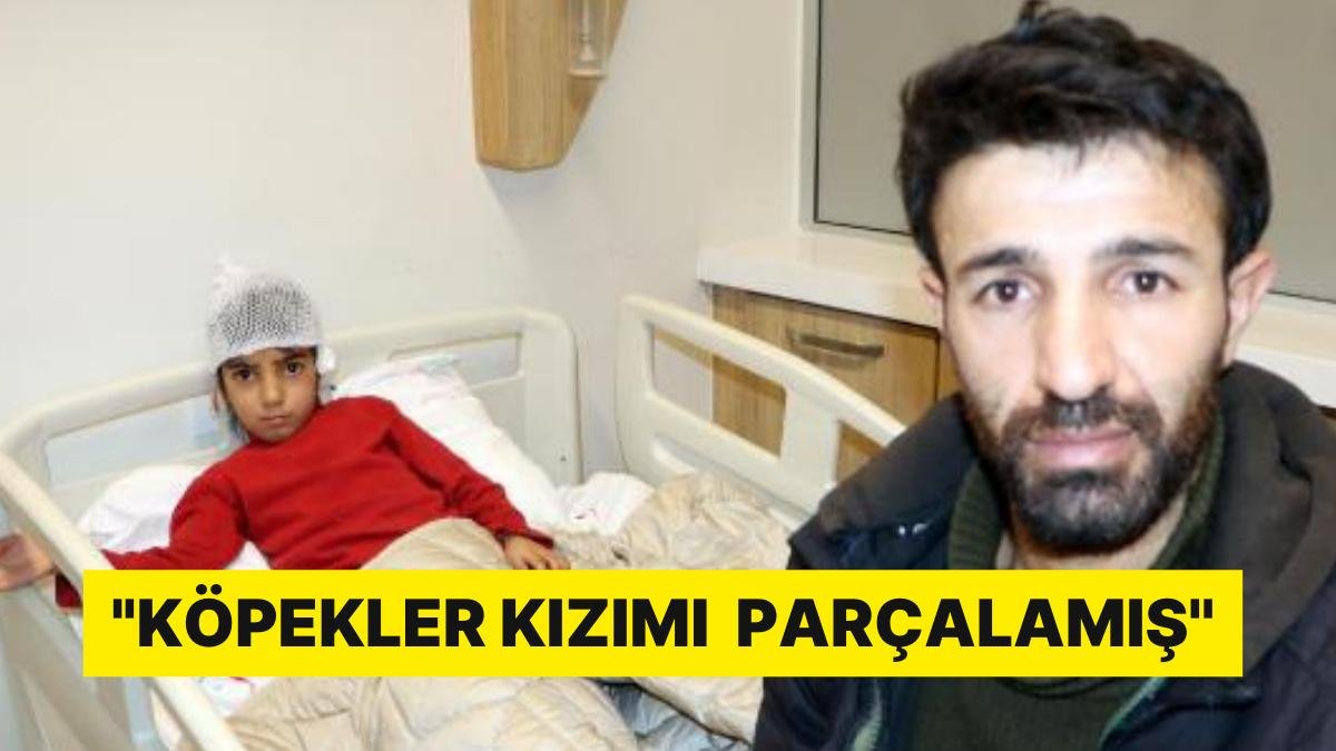 Korkunç Olay! Sokak Köpeklerinin Saldırdığı 8 Yaşındaki Ela’nın Kulağı Koptu: ”Çok Zor Bir Durum”