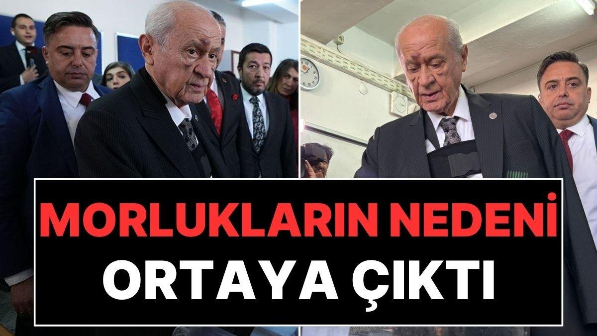 Devlet Bahçeli’nin Yüzündeki Morlukların Sırrı Ortaya Çıktı: Ünlü Gazeteci Kazanın Nedenini Yazdı