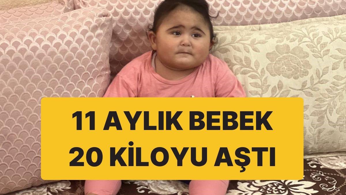 11 Aylık Bebek 20 Kiloyu Aştı: Hormon Bozukluğu Tespit Edildi