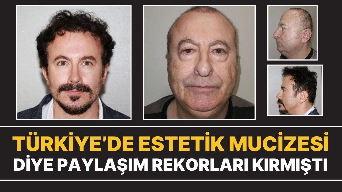 Estetik Mucizesi Diye Paylaşılan Adam Türk Çıktı: “Kafa Nakli Yaptırmadım”