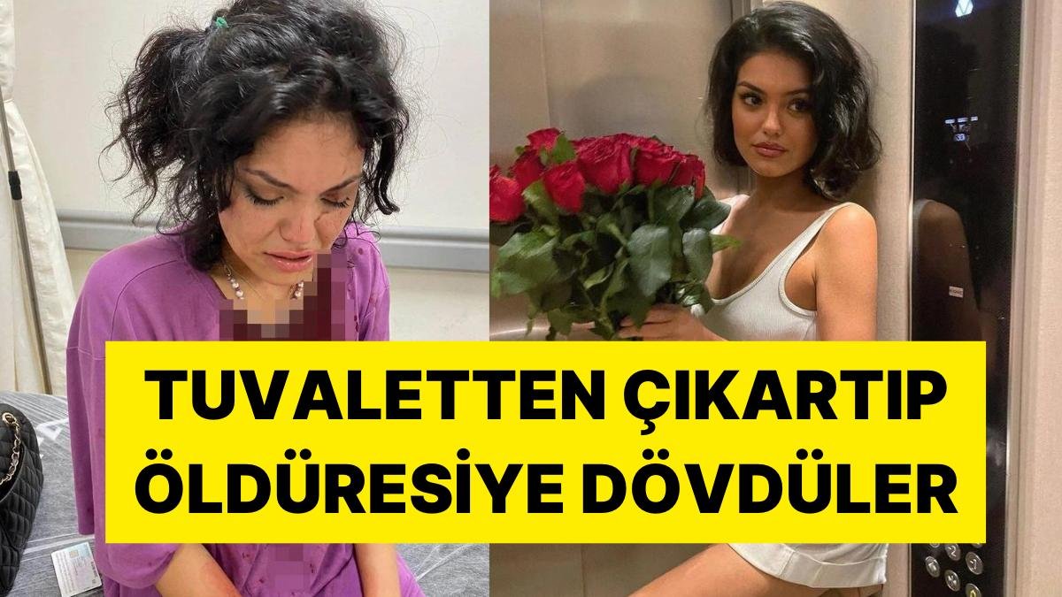 Saldırıya Uğrayan Kısmetse Olur Yarışmacısı Eslem Sena Nur: “Kafama Çakı Soktular”