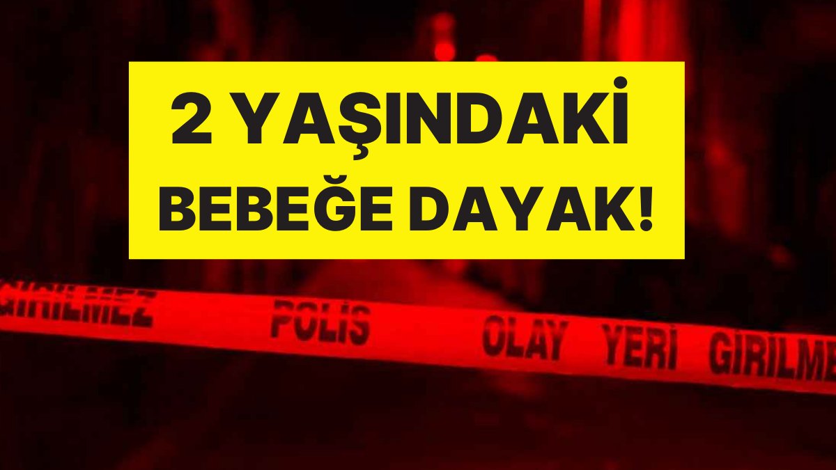 Anne Tutuklandı: 2 Yaşındaki Bebeğe Dayak, Beyin Kanaması Geçirdi