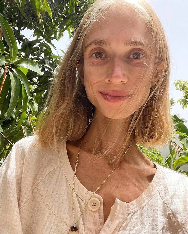 Meyve Diyetiyle 20 Kiloyu Değiştiren Karolina Krzyżak’ın Veda Haberi