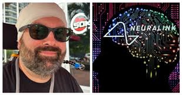 Neuralink’in İnsan Deneği: Düşünce Gücüyle Yeni Robot Kolunu Tamamen Kontrol Etmek