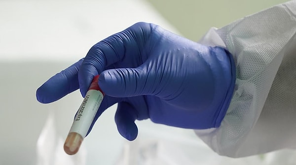 Uyuşturucu Testi Nasıl Yapılır ve Ne Zaman Çıkar?