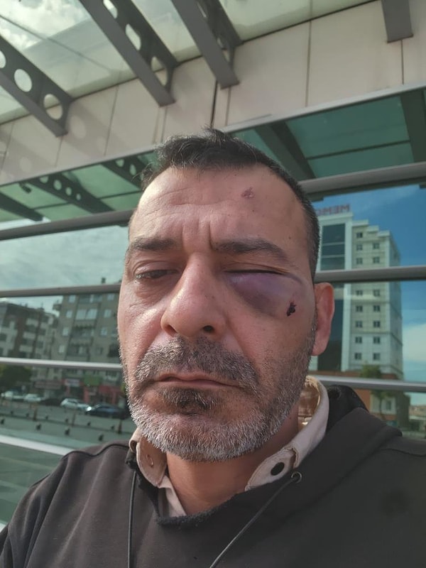 Sosyal Medya Fenomeninin 13 Yaşındaki Oğlu ve Kardeşi Darbedildi