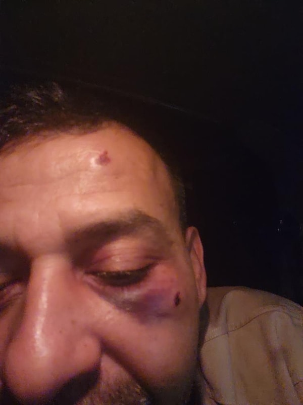 Sosyal Medya Fenomeninin 13 Yaşındaki Oğlu ve Kardeşi Darbedildi